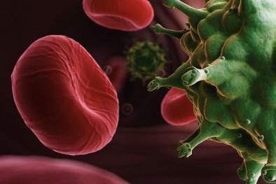 Đã loại bỏ được virus HIV khỏi tế bào người